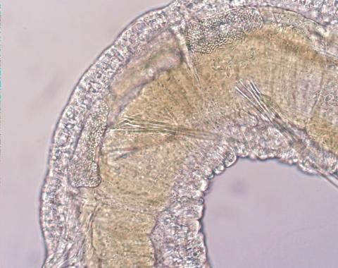 Manayunkia sp. polychaete with microsporidian infection.