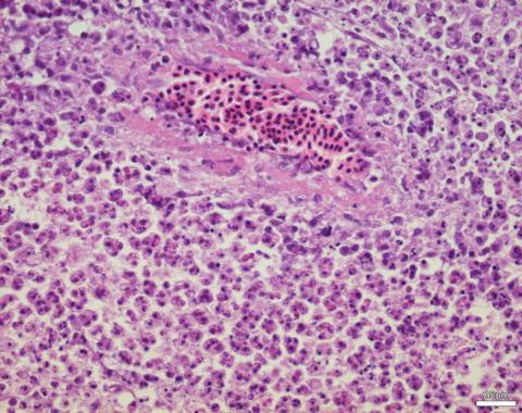 Tissue section showing Ceratomyxa shasta myxospores developing in intestinal wall.