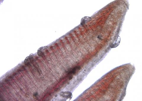 Dactylogyrus on gill filaments.