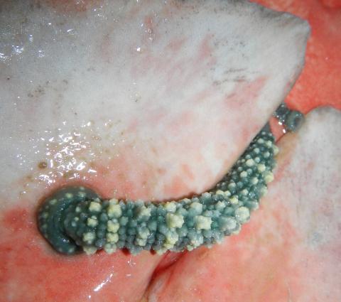 Pontobdella loricata leech on a shark.