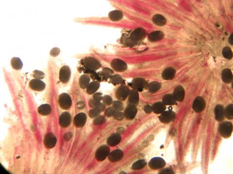 Larval molluscs (glochidia) on gills of salmon.