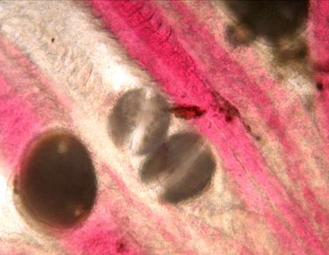 Larval molluscs (glochidia) on gills of salmon.