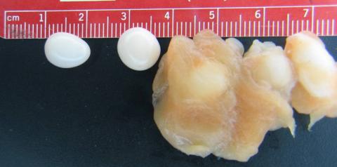 Henneguya cysts from muscle tissue.