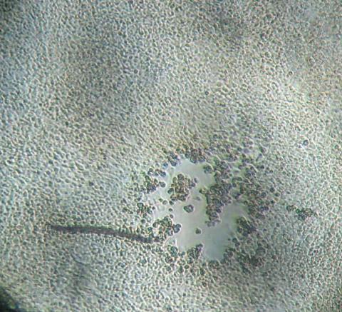 Light micrograph of plaque caused by IHN virus.