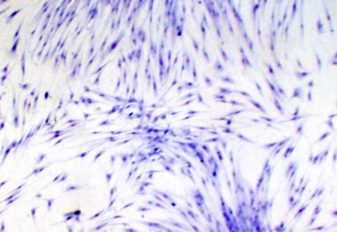 RTG-2 cells inoculated with IPNV