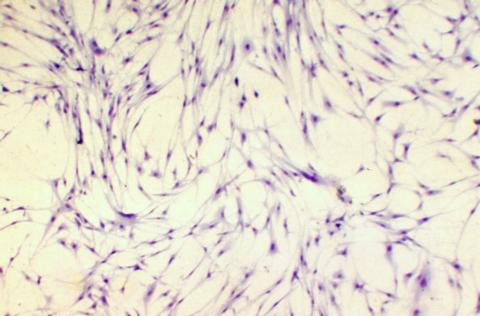 RTG-2 cells inoculated with IPNV