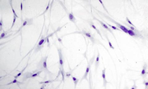 RTG-2 cells inoculated with IPNV