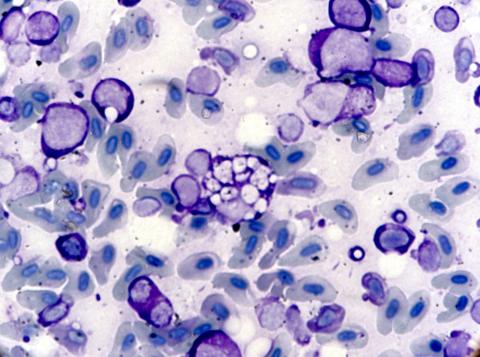 Stained blood smear showing characteristic EIBS inclusion bodies.