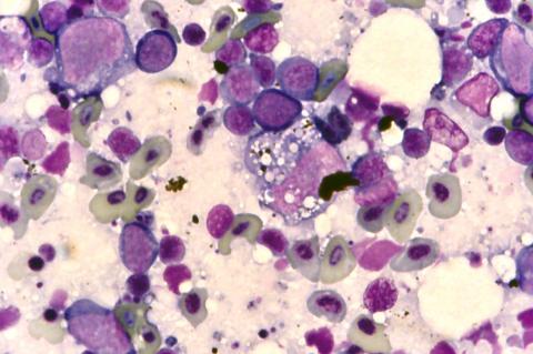 Stained blood smear showing characteristic EIBS inclusion bodies.