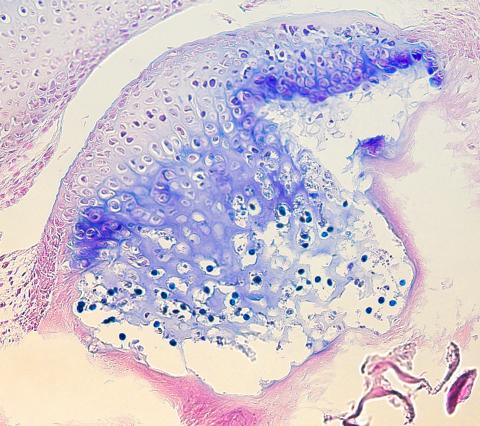 Myxobolus cerebralis developing in head cartilage.