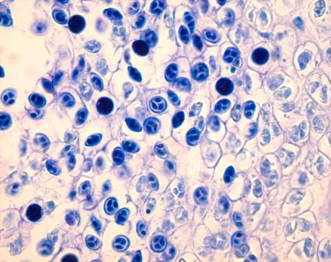 Myxobolus cerebralis developing in head cartilage.