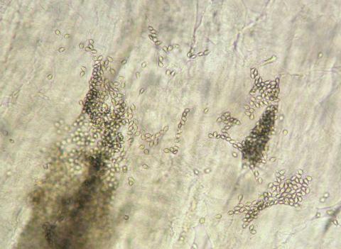 Ruptured Myxobolus insidiosus cysts in muscle.
