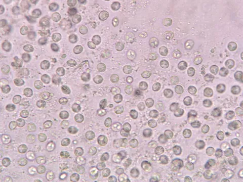 Micrograph showing crushed Myxobolus squamalis cyst, containing many mature myxospores.