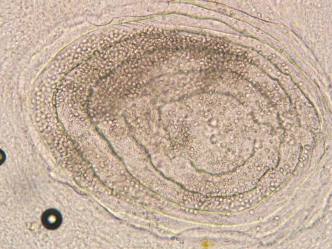 Myxobolus squamalis cyst under fish scale.