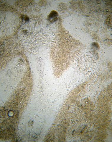 Ichthyophonus growing in dead host tissue.