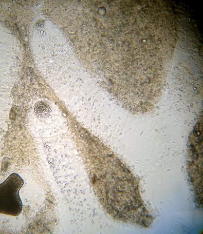 Ichthyophonus growing in dead host tissue.
