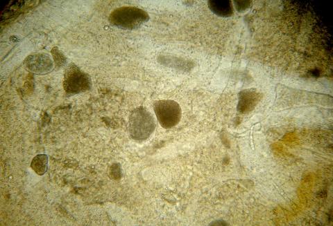 Ichthyophonus growing in dead host tissue.