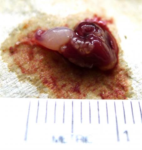 Bluegill heart with white trematode metacercariae.