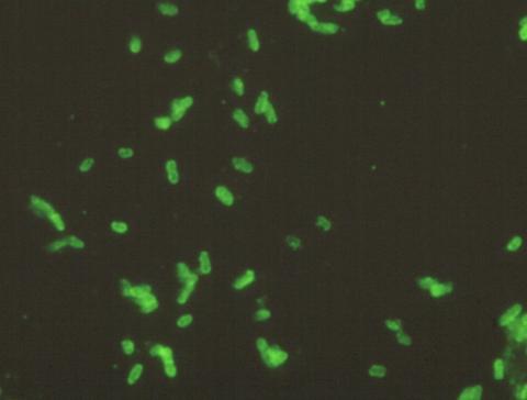 Fluorescence microscopy image of renibacterium cells.