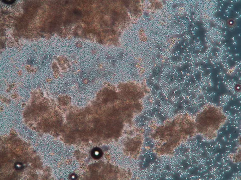 Ruptured microsporidian cyst showing individual spores.