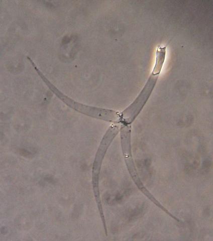 Myxobolus cerebralis actinospore with fired polar filaments.