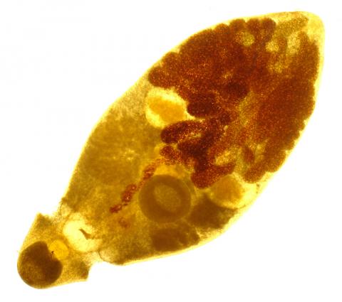 Adult trematode filled with eggs.