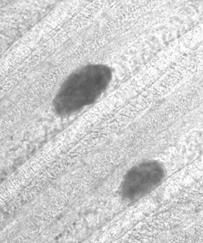 Loma cysts in gill tissue.