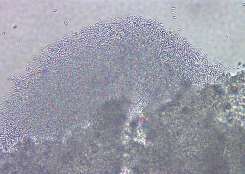 Ruptured microsporidian cyst showing individual spores.