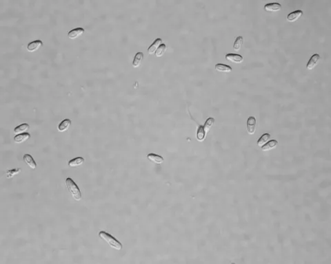 Microsporidian spores.