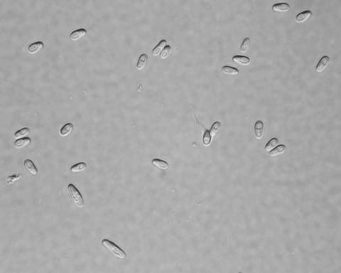 Microsporidian spores.