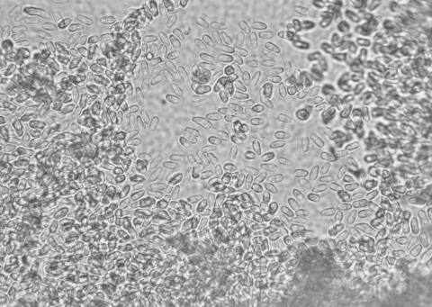 Microsporidian spores.