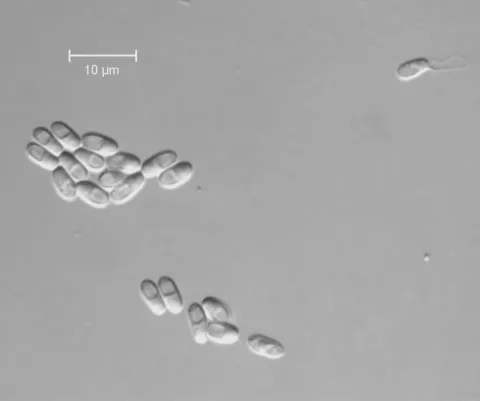 Microsporidian spores.