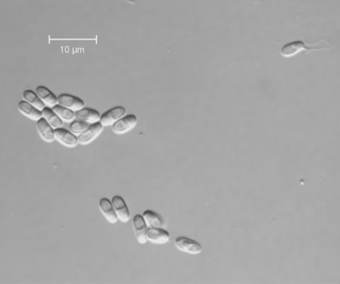 Microsporidian spores.