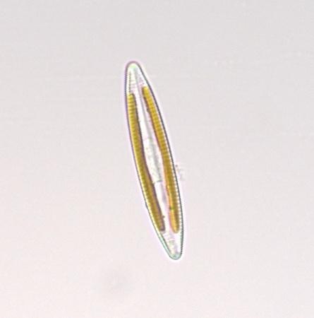 Diatom.