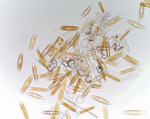 Diatoms: commonly seen in skin scrapes of fish.