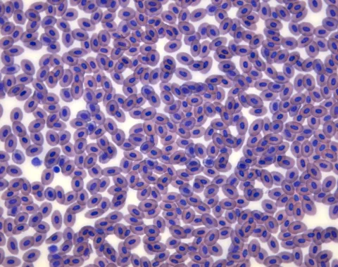 Normal fish blood smear, stained with Diff-Quik.