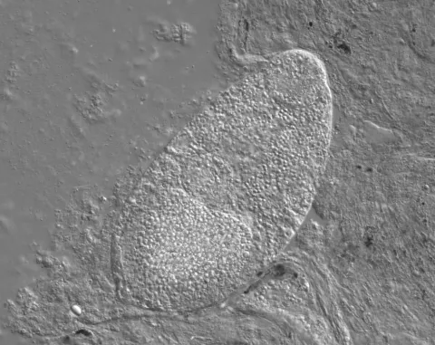 Trematode from kidney of coho salmon.