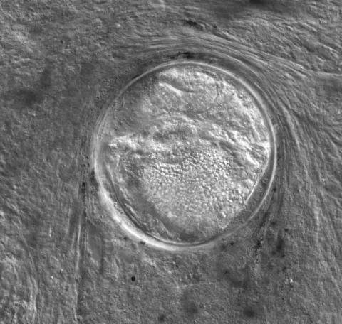 Trematode metacercaria from coho kidney.