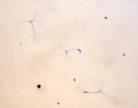 Triactinomyxon spores of M. cerebralis.