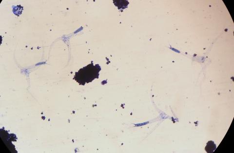 Triactinomyxon spores of M. cerebralis.