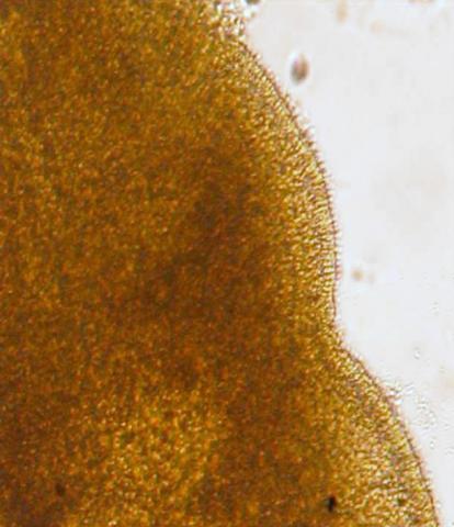 Close-up of cilliated edge of adult sanguinicolid fluke.
