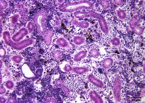 Aeromonas damage to kidney tissue.