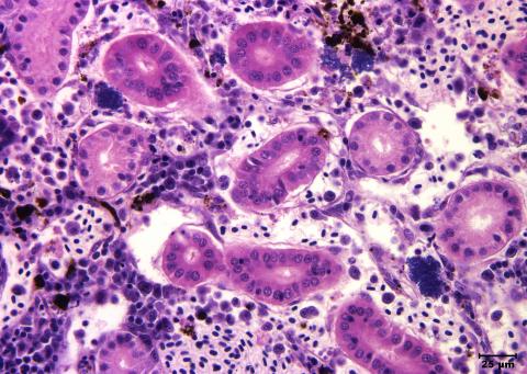 Aeromonas damage to kidney tissue.