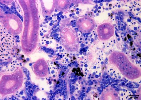 Aeromonas damage to kidney tissue.