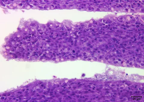 Flavobacterium (thin filaments) adhering to gill epithelium.