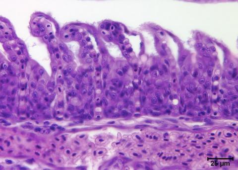 Flavobacterium (thin filaments) adhering to gill epithelium.