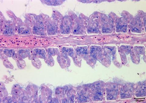 Flavobacterium (thin filaments) adhering to gill epithelium.