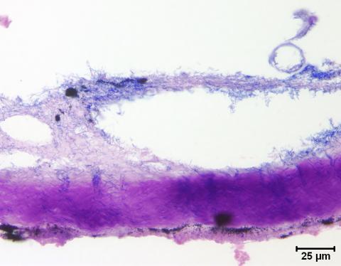 Flavobacterium (thin filaments) adhering to fish skin.