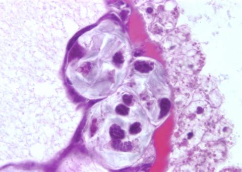 Pansporocysts of M. cerebralis actinospores developing in gut wall of worm host.