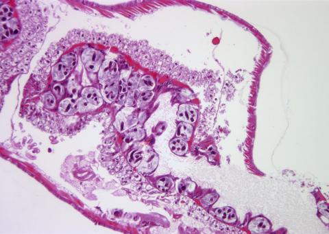 Pansporocysts of M. cerebralis actinospores developing in gut wall of worm host.